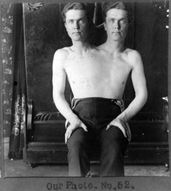 Trick Photograph of a Man with Two Heads,