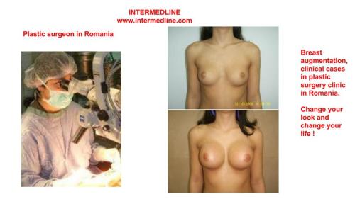 Breast augmentation surgery