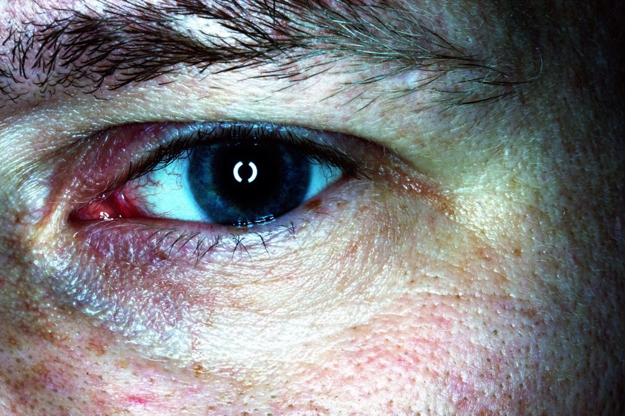 girlrn:  Forensic Camera Sample Pictures Using a SDFI®-TeleMedicine Camera System