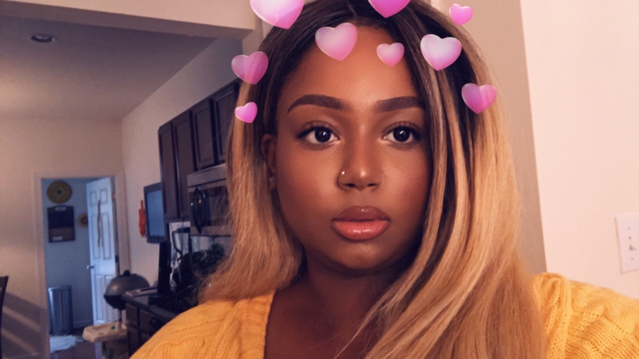 lucidnee:  lorrydii:  lucidnee:  hey  little chin dimple!!! you are so beautiful,