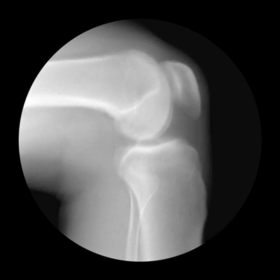ratak-monodosico:  X-Ray Gifs Cameron Drake 