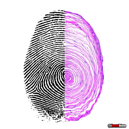  A Pacinian Fingerprint at the Scene of the CrimeWith all of this criminal activity it’s not s