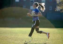 oats-n-whoas:  runningtheremedy:  blondebarbells:  lawgirlrunning:  unusual-passions:  Badly injured at a fundraising car wash. Lost leg but returned to soccer and is now playing at the college level.  BAD. ASS. Tears in my eyes a little. Good reminder