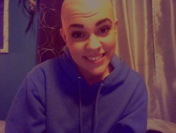 byepeasant:  About two years ago I posted the first picture of me without my hair online. Since then I haven’t really chosen to talk about it all that much anymore. From time to time, I’m really ashamed and I always wish that I wasn’t this way..
