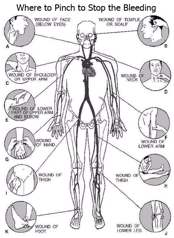 unrepentantwarriorpriest:  Self defense, something everyone should know, because