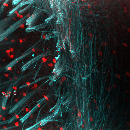 Maximum intensity projection of an optically cleared mouse brain labelled with Alexa 488-Neurofilame