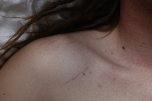 ginocchia:  My boyfriend’s stretch marks, one of the most beautiful things I’ve ever seen.
