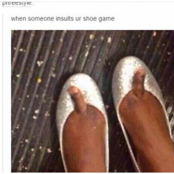 funny-hood-comedy:  Those are some ugly ass toes tho