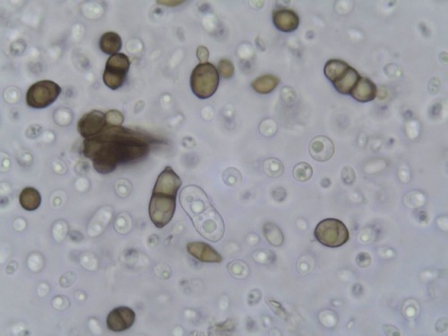 The sooty moulds (fungi) collected and observed from different hosts (Trochetiopsis x benjaminii, So