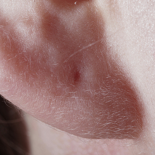 unselect:  Bertrand Boissimon  
