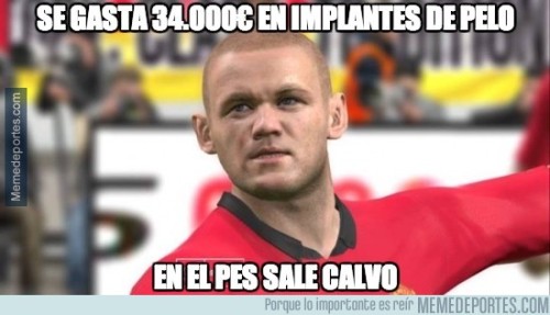 elrinconcico:  A los del PES se la suda, tu has sido calvo toa tu vida.