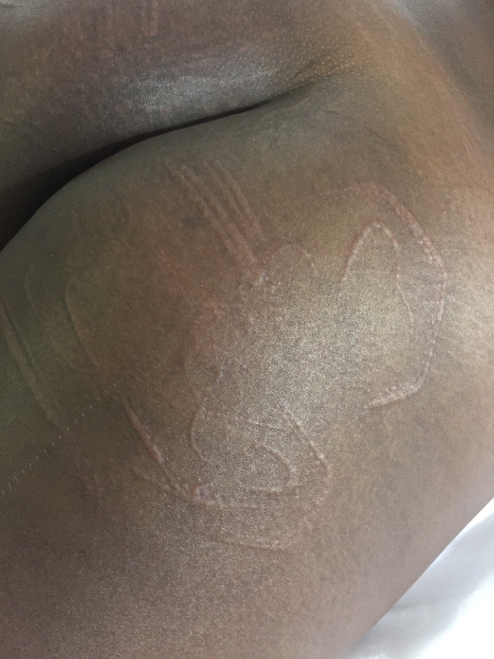 prettyperversion: Beautifully Beaten and bruised  @prettyperversion Photographer
