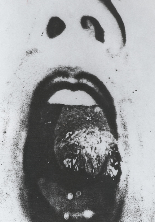 magictransistor:  Jacques-André Boiffard. Photomontage, Renée Jacobi, Masque de Carnaval, Gros Orteil, Masque de Carnaval, Sans Titre, Sous le Masque Pierre Prèvert, Firearm, Morphine and Strychnine Bulbs, Bouche, Sans Titre. 1929-1933. 