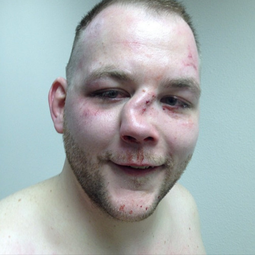 Andy Eichholz is an MMA (mixed martial arts) fighter who goes by the nickname “Ice Cold.” After bein