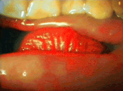 thesunawaitsus:  A kiss from the view of the inside of the mouth. This actually makes me incredibly uncomfortable.