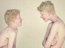beskt:  Gustavo Lacerda - Albinos Project:“For