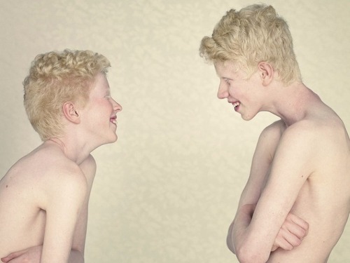 beskt:Gustavo Lacerda - Albinos Project:“For some years, albinism and its peculiar beauty arouse my 