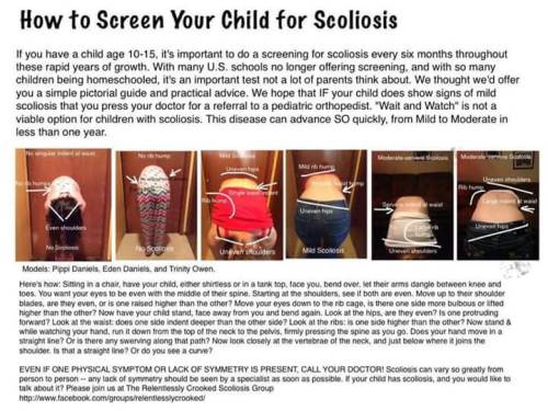 I haven’t told many people but late last year my son (now 15) was diagnosed with scoliosis by 