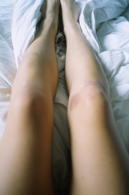 breaths:  Koh Phi Phi, Thailand, Summer 2013Travel bruises 