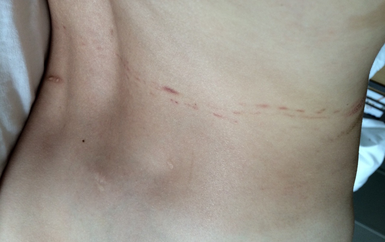 camdamage:  Rope marks from time with @strictly-dirtyvonp a few days ago, mingling