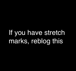 boys-and-suicide:  I just want everyone to see stretch marks are completely normal and so many people have them. 