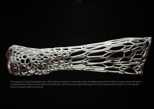 nichbchsr:  xerovoltage:  camerapits:  futuretechreport:  Cortex: The 3D-Printed Cast After many centuries of splints and cumbersome plaster casts that have been the itchy and smelly bane of millions of children, adults and the aged alike the world over,