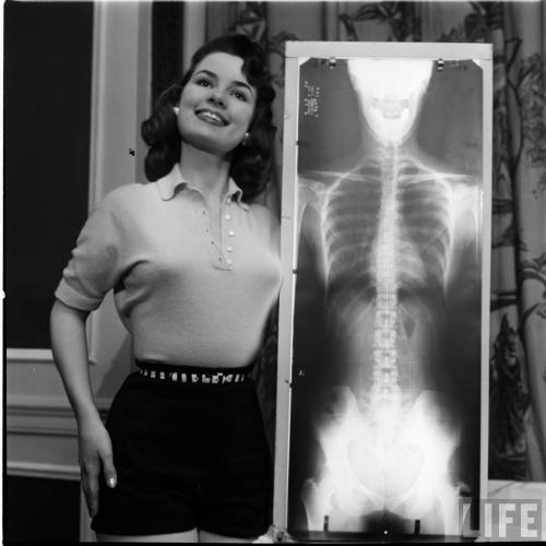 Contestant in a chiropractors beauty pageant(Wallace Kirkland. 1956)