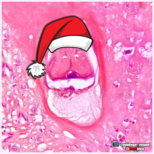 Santa Larvae Hurry down my cecum tonight! i♡histo A nematode larva (Contracaecum) in the digest