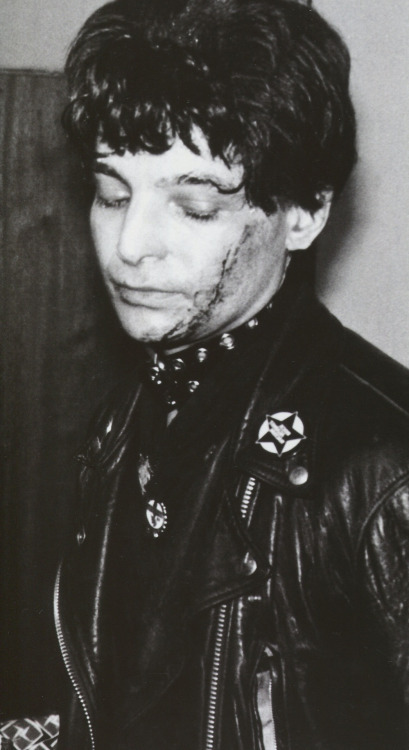 Alan Vega