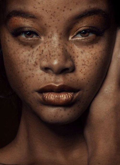 the-real-eye-to-see: Beautiful women of color with freckles! weaknesses~ <3