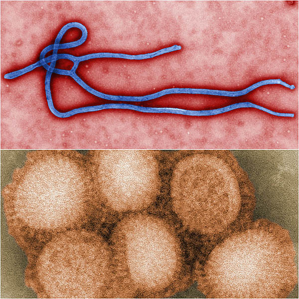 ucsdhealthsciences:  Worse than EbolaBy now, the top false-color micrograph should