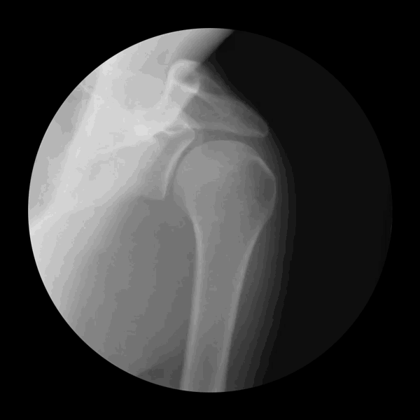 bluecaptions:  X-ray GIFs showing joints in motion.