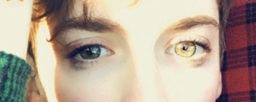 glumshoe:  argumate:   glumshoe:  “Brownish” may be an uncelebrated eye color, but on the bright side, they turn yellow in sunlight:  can you please stop being a fanfiction character, for one day, I’m begging you   and they turn VIOLET when I’m