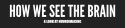 tobeagenius:  Recent technological and scientific advances have fuelled a neuroscientific revolution. Imaging techniques such as those shown above have given us an unprecedented view into the structure and function of our brain.