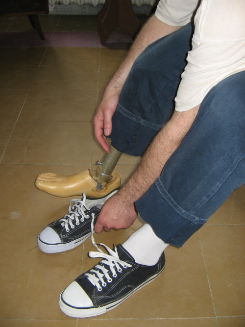 amputee pretender on prosthetic leg. And, of course - converse sneakers