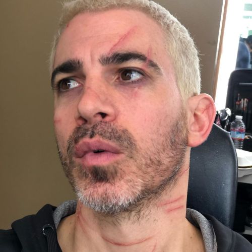 Birds of Prey BTS | Chris Messina as ‘Victor Zsasz’