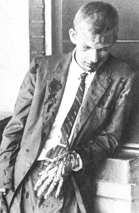 historicaltimes: Photo of James Zwerg, a college student from Wisconsin, after he was beaten by a mob of segregationists in Alabama for being a Freedom Rider. 1961 via reddit 