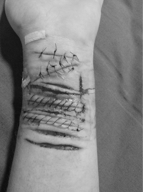 dancing with scars