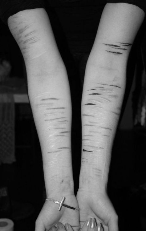 We are dying from overthinking.
