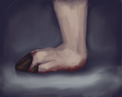 gaeilge:cos le sail tite cludithe i gortu agus galaru craiceann
english: foot with fallen heels with the sole covered in lesions and infection