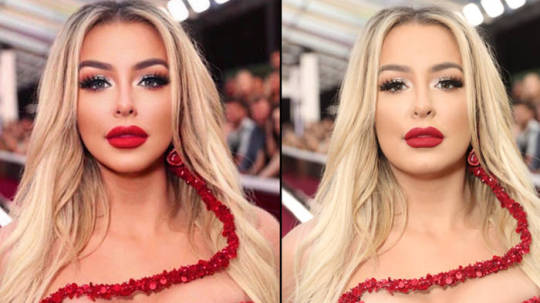 Tana Mongeau Plastic Surgery