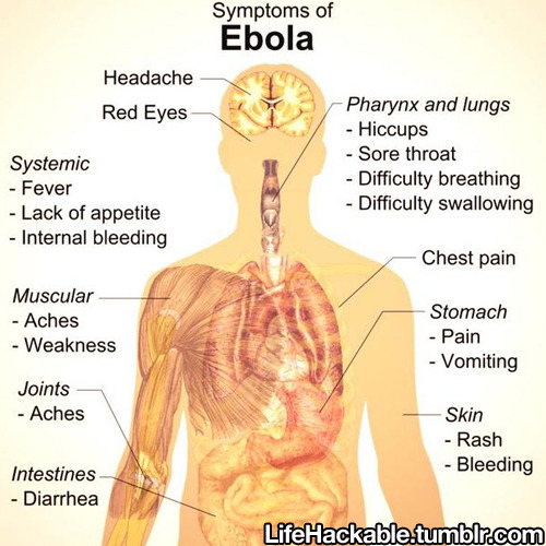 lifehackable:  With the Ebola virus now spreading in the United States, it’s important to know the symptoms. Reblog and pass it on. 