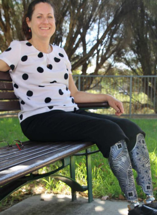 Australian nurse who lost her legs from meningitis.  There’s a pic of her sitting in a wheelchair fr