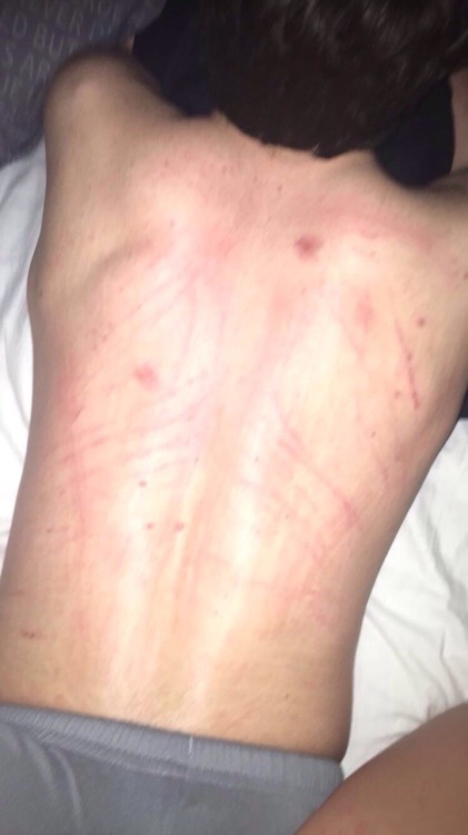 hickey-aesthetic: from @xamyxliux