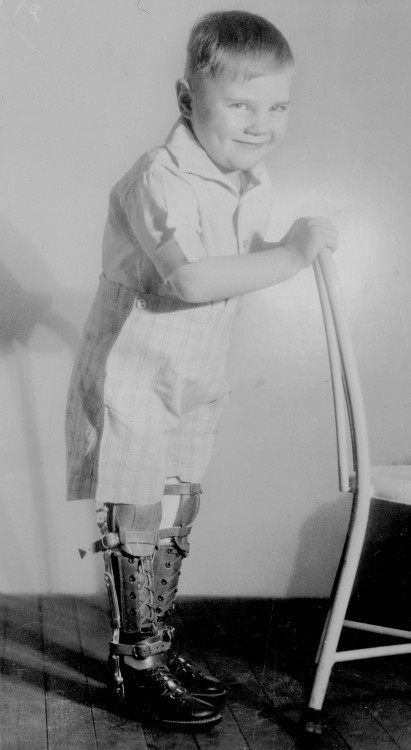 Boy with polio leg braces When: 1950s (?) Where: Unknown