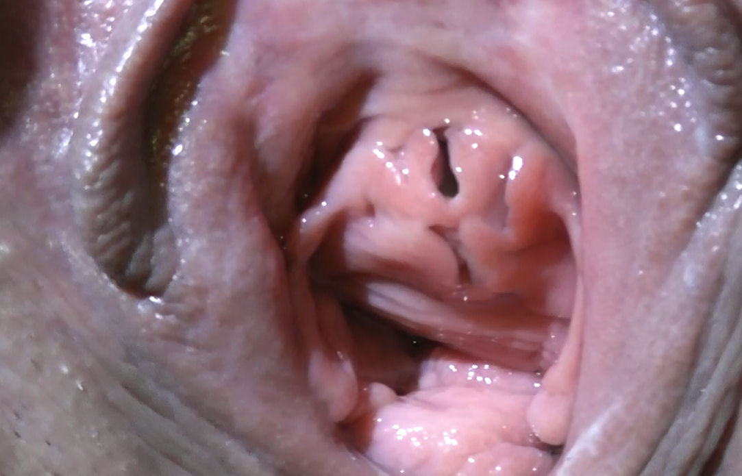 klrspussy:  Peeing while holding my labia open so you can clearly see my urethra