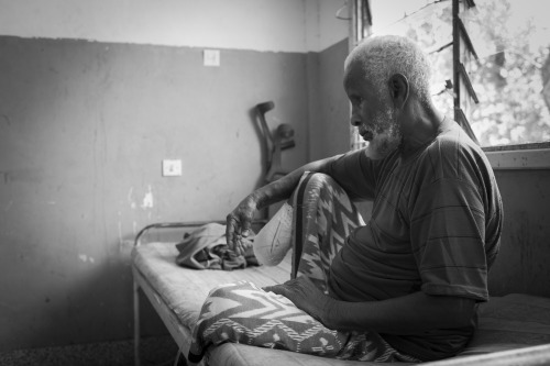 Mogadishu, Somalia. An amputee victim of a landmine placed by Al-Shabab extremists.