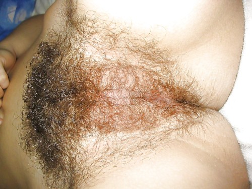 Only Hairy Women
