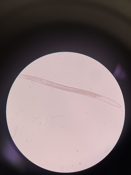 Now That My Nematology Class Is Over, Here's Some Of The Good Pictures I Got Of Some Species My Professor