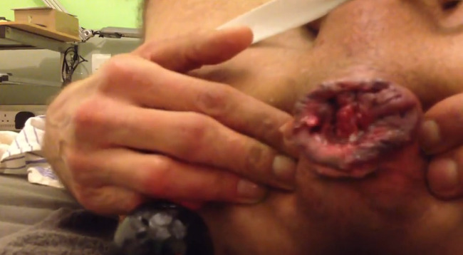 steffan-16:  Pleasuring my wrecked hole.